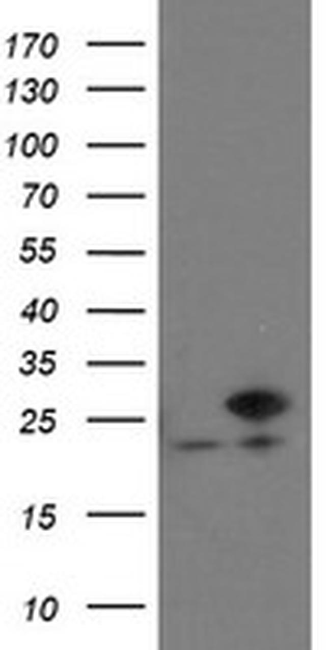 VBP1 Antibody in Western Blot (WB)