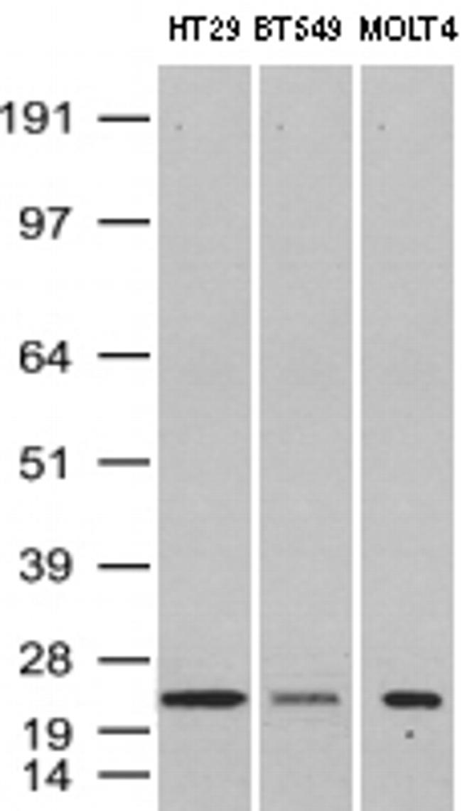 VBP1 Antibody in Western Blot (WB)