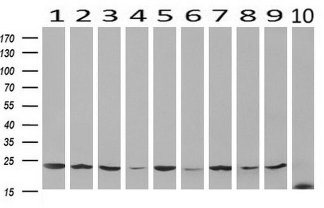 VBP1 Antibody in Western Blot (WB)