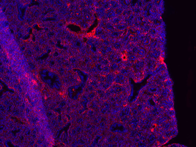 VCAM-1 Antibody in Immunohistochemistry (Frozen) (IHC (F))