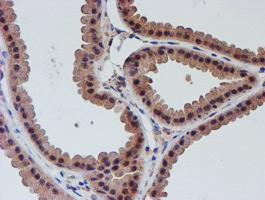 VCAM1 Antibody in Immunohistochemistry (Paraffin) (IHC (P))