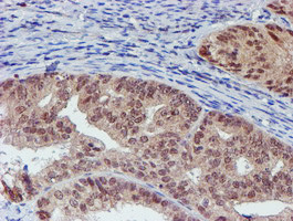 VCAM1 Antibody in Immunohistochemistry (Paraffin) (IHC (P))