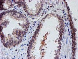 VCAM1 Antibody in Immunohistochemistry (Paraffin) (IHC (P))