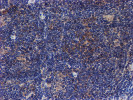 VCAM1 Antibody in Immunohistochemistry (Paraffin) (IHC (P))