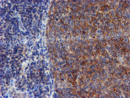 VCAM1 Antibody in Immunohistochemistry (Paraffin) (IHC (P))