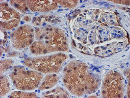 VCAM1 Antibody in Immunohistochemistry (Paraffin) (IHC (P))