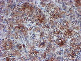 VCAM1 Antibody in Immunohistochemistry (Paraffin) (IHC (P))