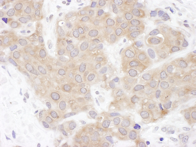 VCIP135 Antibody in Immunohistochemistry (IHC)