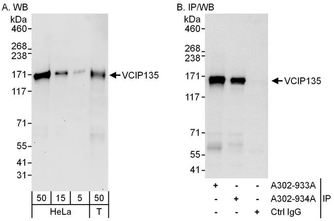 VCIP135 Antibody in Western Blot (WB)