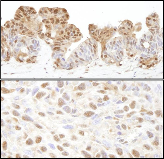 VCP Antibody in Immunohistochemistry (IHC)