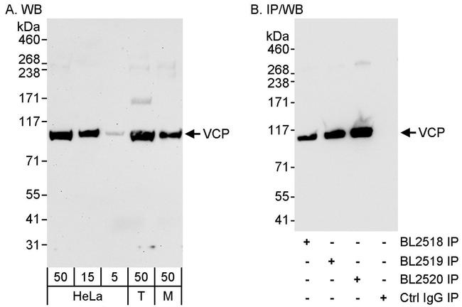 VCP Antibody in Western Blot (WB)