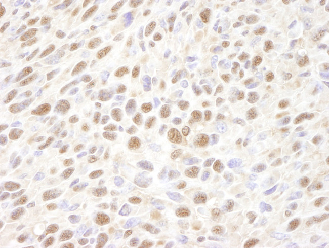 VCP Antibody in Immunohistochemistry (IHC)