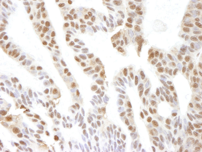 VCP Antibody in Immunohistochemistry (IHC)