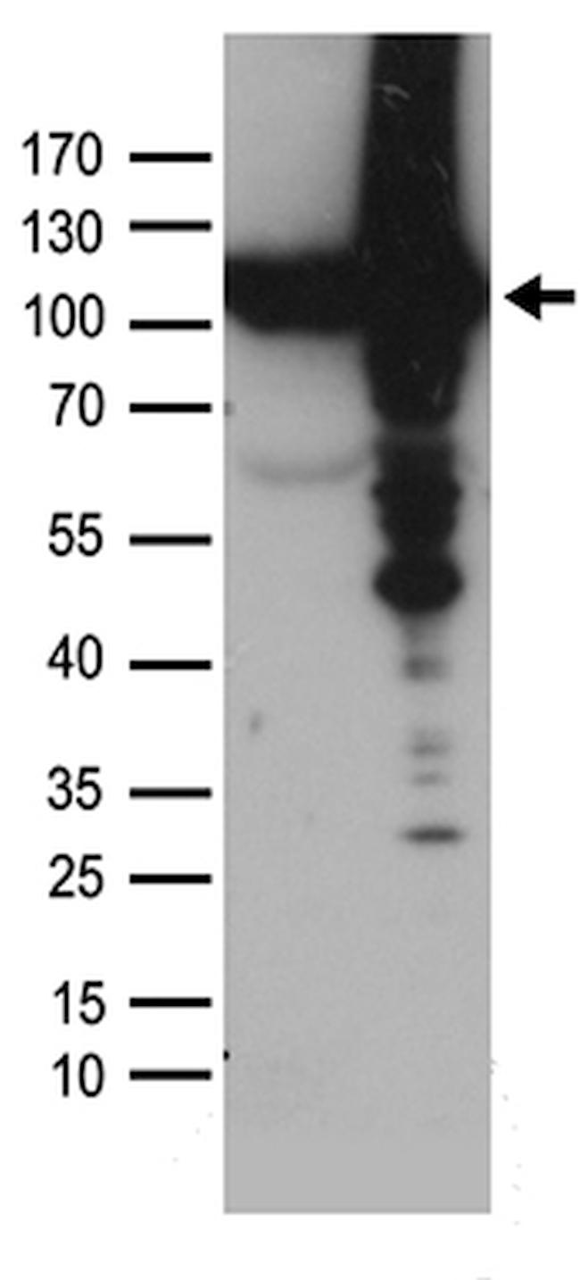 VCP Antibody in Western Blot (WB)