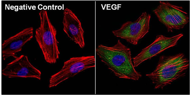 VEGF Antibody in Immunocytochemistry (ICC/IF)