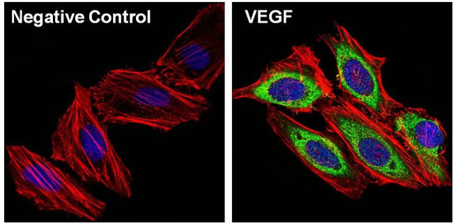 VEGF Antibody in Immunocytochemistry (ICC/IF)