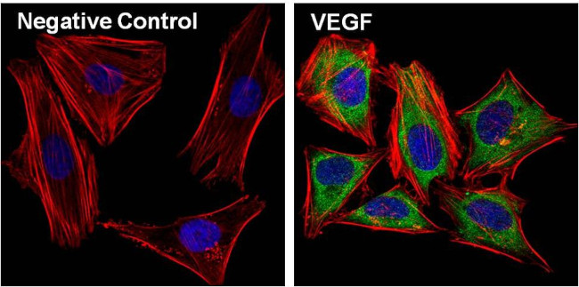 VEGF Antibody in Immunocytochemistry (ICC/IF)