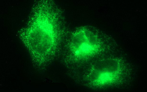 VEGFB Antibody in Immunocytochemistry (ICC/IF)