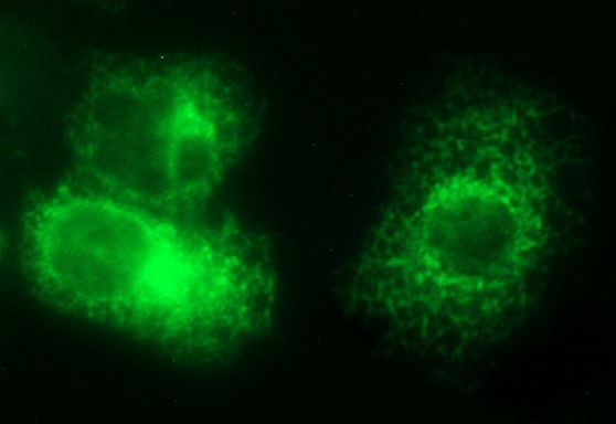 VEGFB Antibody in Immunocytochemistry (ICC/IF)