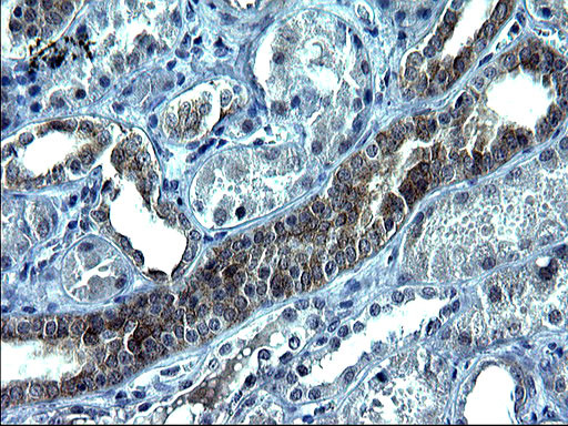 VEGFB Antibody in Immunohistochemistry (Paraffin) (IHC (P))