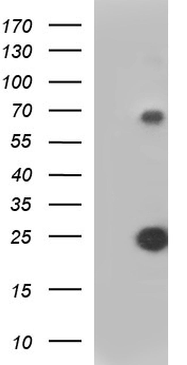 VEGFB Antibody in Western Blot (WB)