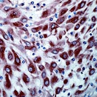 VEGF Receptor 3 Antibody in Immunohistochemistry (Paraffin) (IHC (P))