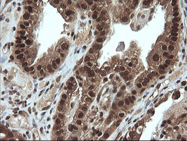 VHL Antibody in Immunohistochemistry (Paraffin) (IHC (P))