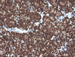 VHL Antibody in Immunohistochemistry (Paraffin) (IHC (P))