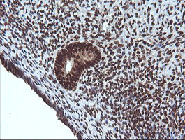 VHL Antibody in Immunohistochemistry (Paraffin) (IHC (P))