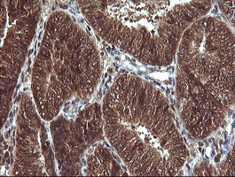 VHL Antibody in Immunohistochemistry (Paraffin) (IHC (P))