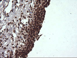 VHL Antibody in Immunohistochemistry (Paraffin) (IHC (P))