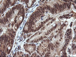 VHL Antibody in Immunohistochemistry (Paraffin) (IHC (P))