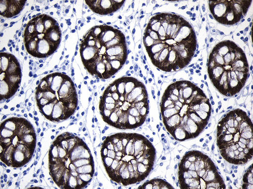 VIL1 Antibody in Immunohistochemistry (Paraffin) (IHC (P))