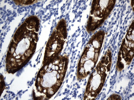 VIL1 Antibody in Immunohistochemistry (Paraffin) (IHC (P))