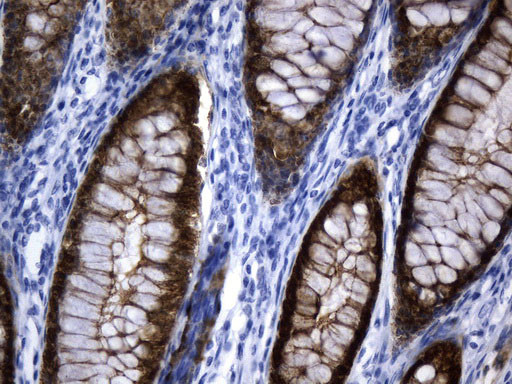 VIL1 Antibody in Immunohistochemistry (Paraffin) (IHC (P))