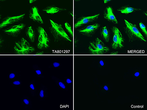 VIM Antibody in Immunocytochemistry (ICC/IF)