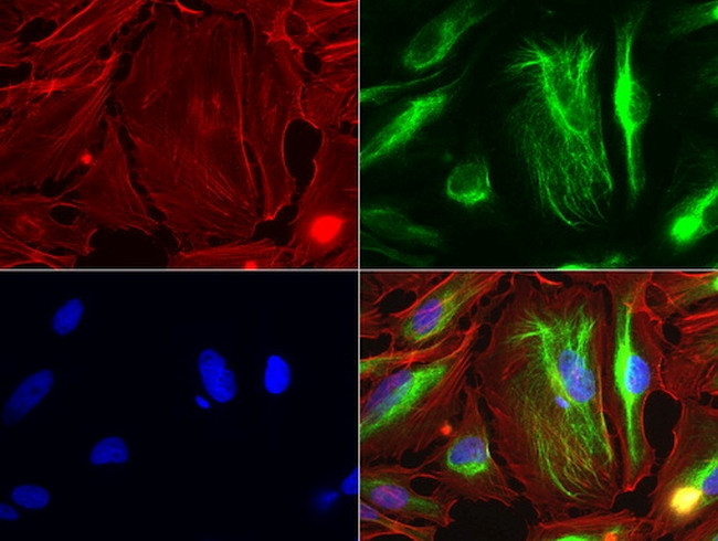 VIM Antibody in Immunocytochemistry (ICC/IF)