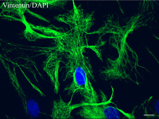 VIM Antibody in Immunocytochemistry (ICC/IF)