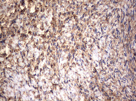 VIM Antibody in Immunohistochemistry (Paraffin) (IHC (P))