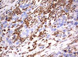 VIM Antibody in Immunohistochemistry (Paraffin) (IHC (P))