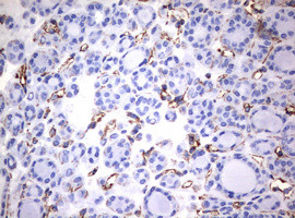 VIM Antibody in Immunohistochemistry (Paraffin) (IHC (P))