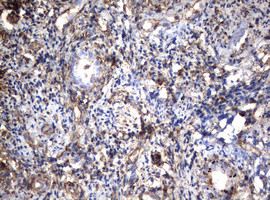 VIM Antibody in Immunohistochemistry (Paraffin) (IHC (P))