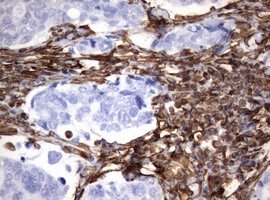 VIM Antibody in Immunohistochemistry (Paraffin) (IHC (P))