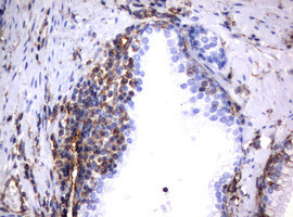 VIM Antibody in Immunohistochemistry (Paraffin) (IHC (P))