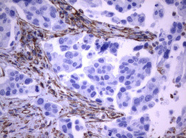 VIM Antibody in Immunohistochemistry (Paraffin) (IHC (P))