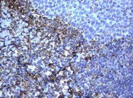 VIM Antibody in Immunohistochemistry (Paraffin) (IHC (P))