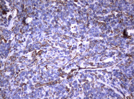 VIM Antibody in Immunohistochemistry (Paraffin) (IHC (P))