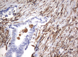 VIM Antibody in Immunohistochemistry (Paraffin) (IHC (P))