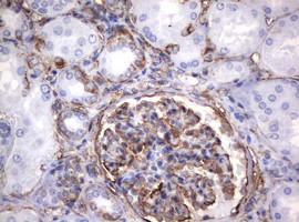 VIM Antibody in Immunohistochemistry (Paraffin) (IHC (P))