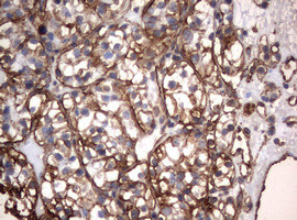 VIM Antibody in Immunohistochemistry (Paraffin) (IHC (P))